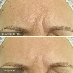 Best Sale 🤩 Mirenesse Retinew Peel Mask -with Retinol/Lactic Acid/Rosehip Oil 5g/0.17oz 🔔 -MIRENESSE Sales Store 0088924ebd0f42e5ab320bb0497c050d 1080x