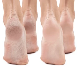 Budget ❤️ Mirenesse Active Foot Renew Treatment Booties With 15 Golden Oils + Antiageing Retinol 🥰 -MIRENESSE Sales Store 0df54357046c4413a0f9e5c629b0642e 9edf3bd1 def9 4024 bd26 8a8ed4bf30af 1080x