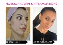 Brand new 👏 Mirenesse NEW Skin Secrets Pro Kit Amazing LED Mask - Red Led + 7 in 1 Treatments FDA Approved 🥰 -MIRENESSE Sales Store 143abc849c624572a3559d29961fbd1f 1080x