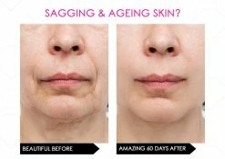 Brand new 👏 Mirenesse NEW Skin Secrets Pro Kit Amazing LED Mask - Red Led + 7 in 1 Treatments FDA Approved 🥰 -MIRENESSE Sales Store 1bd43173512c473f8f3e83056aa2d7ad 1080x