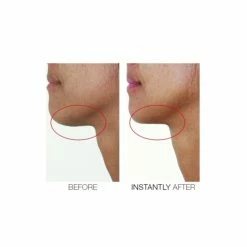 Cheap ⭐ Mirenesse Chin Tuck V Shape Lifting Serum 🥰 -MIRENESSE Sales Store 3d6fe5261976422faad6658138e695d9 f4aa29eb 9b58 4ab0 9965 9c93e2578a52 1080x
