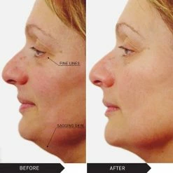 Deals 💯 Mirenesse Velvet Maxisculpt V Shape Collagen Gel + Free Mini 🛒 -MIRENESSE Sales Store 3dd3c9a1506549469168daff37d6f05f 5c913d35 ba4f 4e4e 86fe 6ef53422a020 1080x