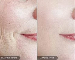 Best Pirce 🔥 Mirenesse Endless Youth Instant Filler 🎉 -MIRENESSE Sales Store 55358b2f469b4a879b03a4f972098fe6 1080x