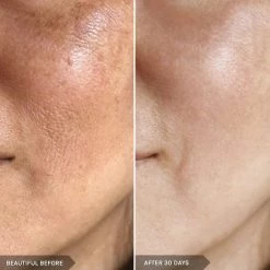 Best Pirce 🎉 Mirenesse Power Lift Night Renewal Cream Gen II 5g/017oz WITH NIACINAMIDE + RETINOL + PEPTIDES 🔥 -MIRENESSE Sales Store 620e09a026834c27a3e04ce01261c00f e8909533 3fd3 4566 8165 ab72631e566f 1080x