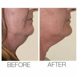 Best reviews of ✔️ Mirenesse Best Selling Velvet Maxi Lift Airbrush Foundation + Maxisculpt Collagen Primer Filler 🎁 -MIRENESSE Sales Store 6bba96a2c0164064b2fd9f21310e0bff b19da5f4 8120 4cb2 8a90 ccdd453cf3d6 1080x