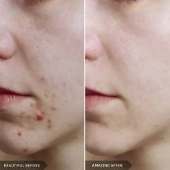 New 🥰 Mirenesse Powerful Night Booster Duo - Retinol + Niacinamide + Peptides ⭐ -MIRENESSE Sales Store 6c4ccf8b571e44a19084996e5df914ea 21eb9cb6 326b 4a63 9c14 c14b78ca7f21 1080x