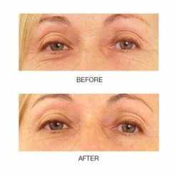 Budget 🎁 Mirenesse Superstar Eye Sheet Mask 10pce Kit ⭐ -MIRENESSE Sales Store 74b522f1700747cdb102ace023fb2fd8 1080x