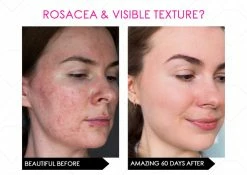 Brand new 👏 Mirenesse NEW Skin Secrets Pro Kit Amazing LED Mask - Red Led + 7 in 1 Treatments FDA Approved 🥰 -MIRENESSE Sales Store 7aedad88d4b145c1abec1f9f77dc22d8 1080x