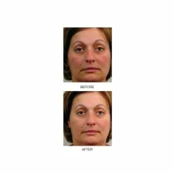 Coupon 🔔 Mirenesse Massage Bead Exfoliating Cleanser 🌟 -MIRENESSE Sales Store 969cbd62a18a44349fb5b7e58e25af01 be5a22ab 29a5 4cd8 a4a9 e8113fa2d20b 1080x