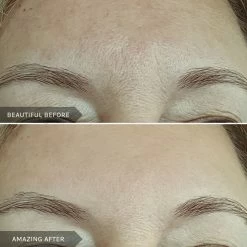 Best Sale 🤩 Mirenesse Retinew Peel Mask -with Retinol/Lactic Acid/Rosehip Oil 5g/0.17oz 🔔 -MIRENESSE Sales Store a08c296660194c699aa2357ba388bac1 1080x