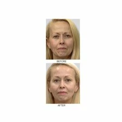 Promo ✨ Mirenesse Wrinkle Zero Night Renewal Booster Cream- Retinol- Vitamin C -Growth factors- Peptides 😍 11 Promo ✨ Mirenesse Wrinkle Zero Night Renewal Booster Cream- Retinol- Vitamin C -Growth factors- Peptides 😍 -MIRENESSE Sales Store aa573417d05a4d9ca21149a6e5c05972 9510287a 7921 47c8 bf03 b062adf19b06 1080x