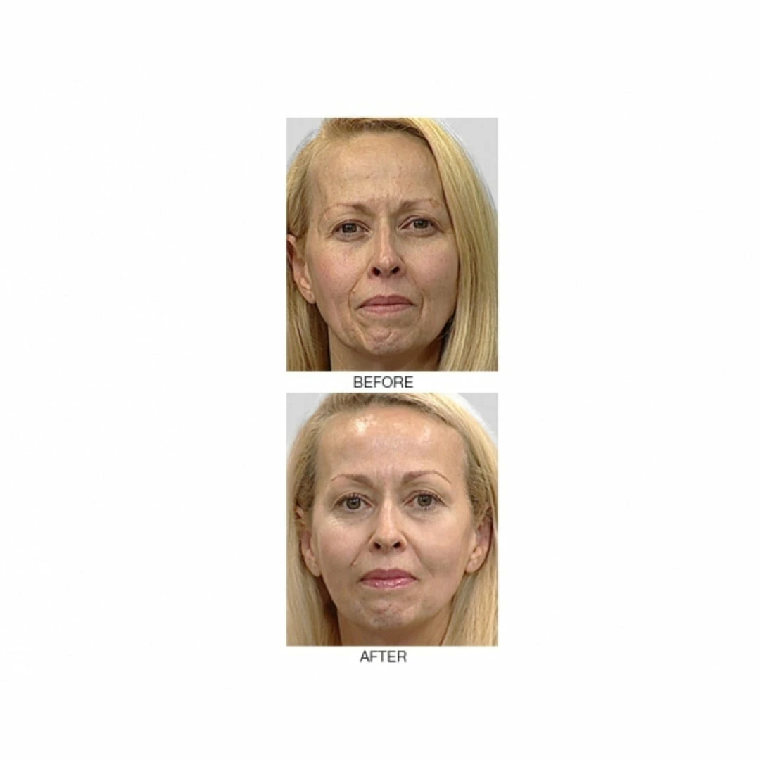 Promo ✨ Mirenesse Wrinkle Zero Night Renewal Booster Cream- Retinol- Vitamin C -Growth factors- Peptides 😍 6 Promo ✨ Mirenesse Wrinkle Zero Night Renewal Booster Cream- Retinol- Vitamin C -Growth factors- Peptides 😍 - Image 6