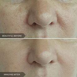 Discount ✔️ Mirenesse Retinew Peel Mask 4pce Kit- Retinol/Lactic Acid/Rosehip Oil 5g/0.17oz ✔️ -MIRENESSE Sales Store ad0a5c46adf44972a9a47453be7dc98a daf50741 b58c 497f aab3 7ab603b1c8e8 1080x