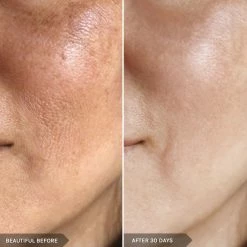 New 🥰 Mirenesse Powerful Night Booster Duo - Retinol + Niacinamide + Peptides ⭐ -MIRENESSE Sales Store b17d5f9c19194d9391e30e9959085358 67697364 c696 4a3c b1b0 26e1c419d7da 1080x