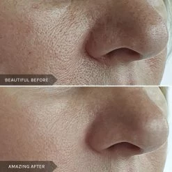 Discount ✔️ Mirenesse Retinew Peel Mask 4pce Kit- Retinol/Lactic Acid/Rosehip Oil 5g/0.17oz ✔️ -MIRENESSE Sales Store c84b6cb878514c01a0bab9686ab7e9b3 9eca5c41 e86f 49cb 8159 e9c3c698817a 1080x