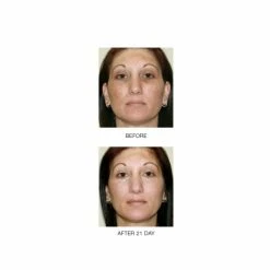 Hot Sale ๐ฏ Mirenesse Wrinkle Zero Night Renewal Serum Mini- Retinol- Vitamin C -Growth factors- Peptides ๐ 10 Hot Sale ๐ฏ Mirenesse Wrinkle Zero Night Renewal Serum Mini- Retinol- Vitamin C -Growth factors- Peptides ๐ -MIRENESSE Sales Store c8998451629e49beb71a2597c166d7c9 b69344ba 29f2 4af5 b8d0 594b62facdd9 1080x