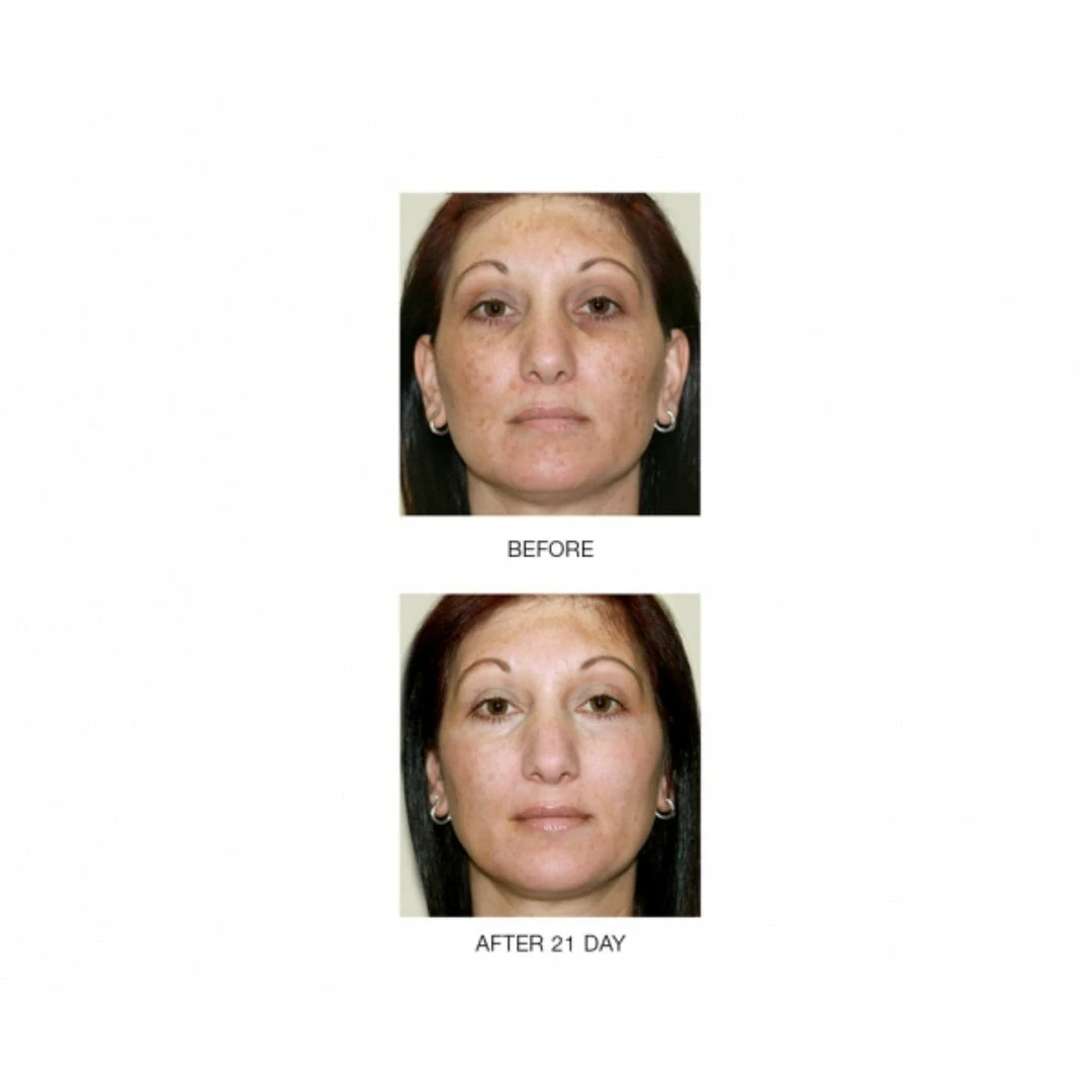 Hot Sale ๐ฏ Mirenesse Wrinkle Zero Night Renewal Serum Mini- Retinol- Vitamin C -Growth factors- Peptides ๐ 5 Hot Sale ๐ฏ Mirenesse Wrinkle Zero Night Renewal Serum Mini- Retinol- Vitamin C -Growth factors- Peptides ๐ - Image 5