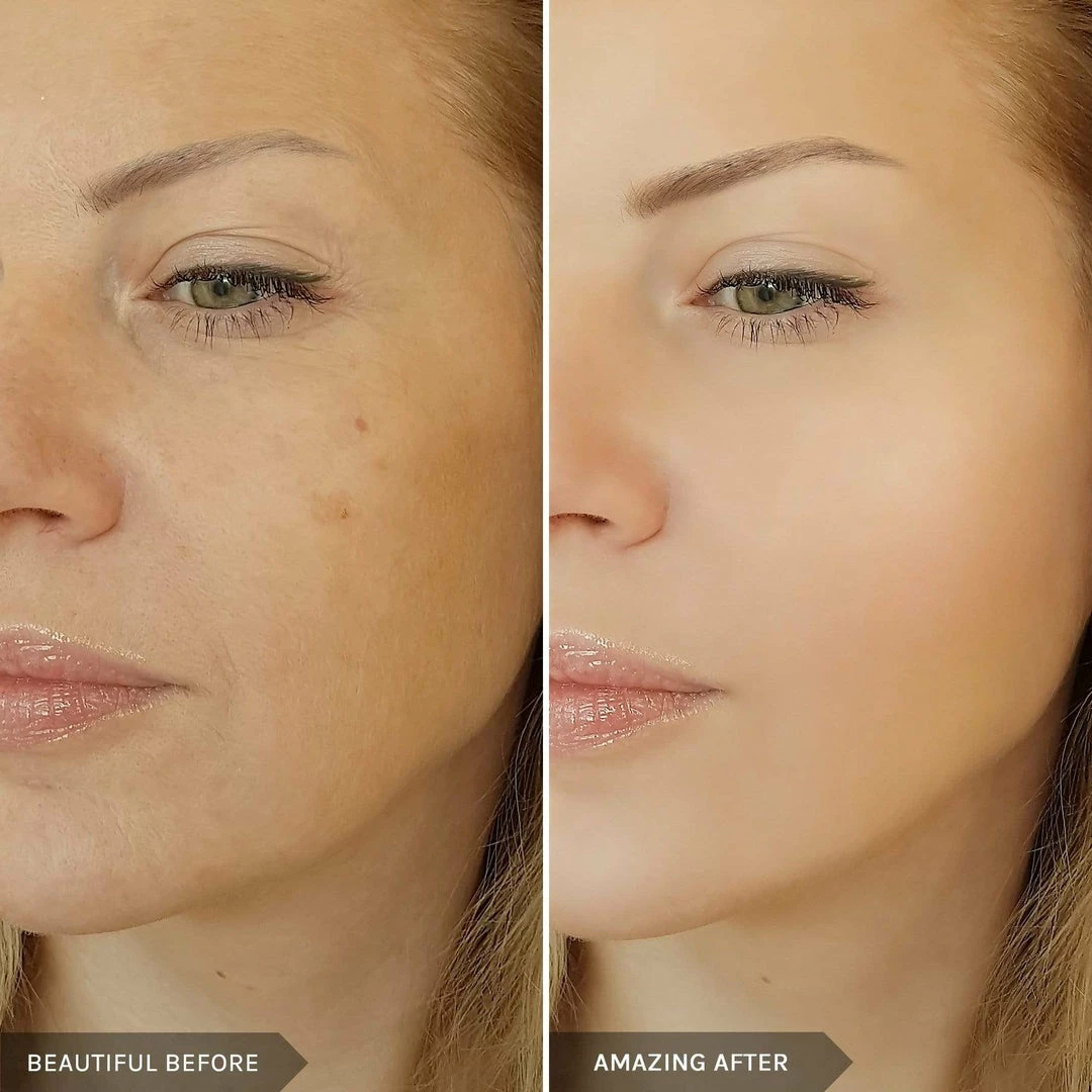 Best deal ๐ Mirenesse Makeup Boosters Instantly Smooth Cover & Fill Duo ๐ฏ 5 Best deal ๐ Mirenesse Makeup Boosters Instantly Smooth Cover & Fill Duo ๐ฏ - Image 5